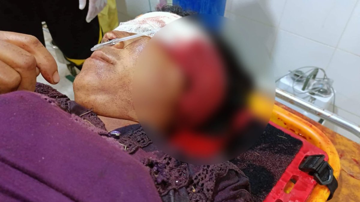 nslwin's tweet photo. A couple killed, 2 children injured

On Oct 23 evening, Junta’s artillery hit a house in Kone Tha village in Karenni State’s capital Loikaw. The husband died on the spot. The wife died at the hospital today. 2 sons, an 8-year-old and a 6-month-old injured, Khit Thit Media reports https://t.co/5M742sE2zj