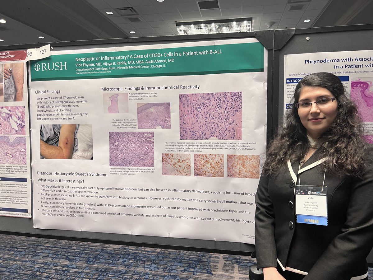 Rush_Pathology's tweet photo. Shout out to our amazing representatives at the #ASDP22 Annual Meeting! Great job everyone! #dermpath #Dermtwitter #PathTwitter https://t.co/EyQwWUlSIm