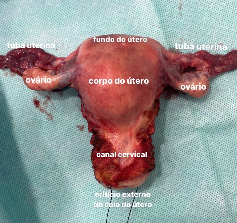 _manuelacabral's tweet photo. Apresento a vocês o órgão mais lindo e incrível do corpo: https://t.co/L8u1em79GJ