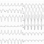 Photo by ECG Cases (@ecg_cases)