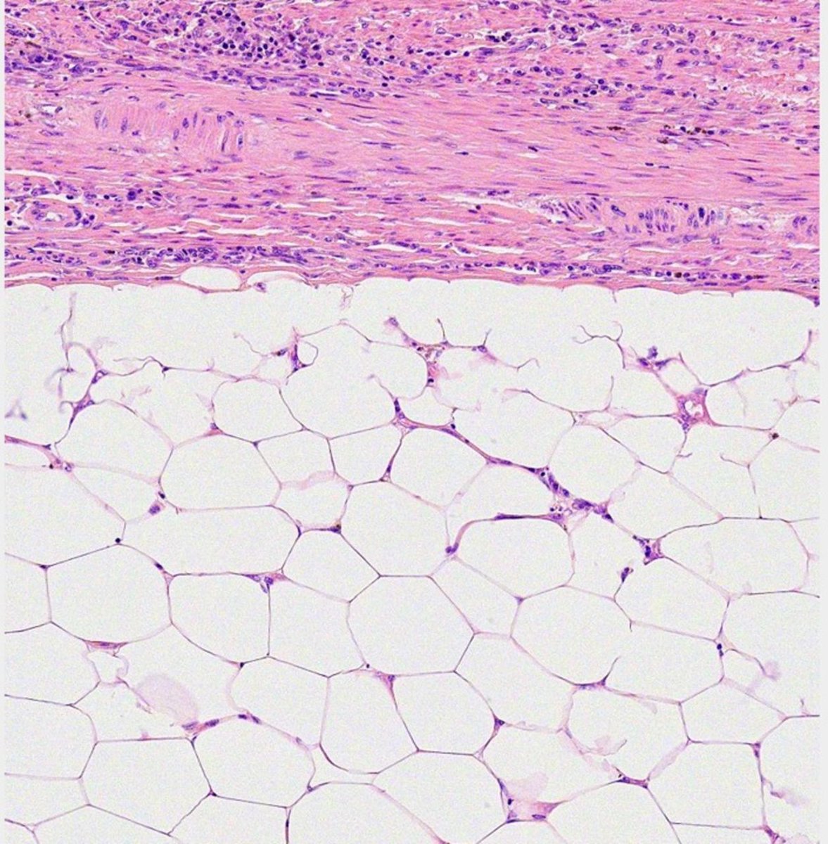 Gut Journal (@gut_bmj) on Twitter photo Read the latest #GISnapshot #GUTSnapshot free to access online on
"Should you trust the radiologist?"
via bit.ly/3z94iMS
<a href="/sunmiha1/">Sun Mi Ha</a> <a href="/SiwanTG/">Siwan</a> <a href="/donalshee/">Donal Sheehan</a> <a href="/shalabolic/">Ahmed Shalabi ☀️</a> <a href="/MrJTJenkins/">Ian Jenkins</a> 
#GITwitter #EndoTwitter #GUTImage #HistoTwitter <a href="/emadelomar/">Emad El-Omar</a> Read the latest #GISnapshot #GUTSnapshot free to access online on
"Should you trust the radiologist?"
via bit.ly/3z94iMS
<a href="/sunmiha1/">Sun Mi Ha</a> <a href="/SiwanTG/">Siwan</a> <a href="/donalshee/">Donal Sheehan</a> <a href="/shalabolic/">Ahmed Shalabi ☀️</a> <a href="/MrJTJenkins/">Ian Jenkins</a> 
#GITwitter #EndoTwitter #GUTImage #HistoTwitter <a href="/emadelomar/">Emad El-Omar</a>