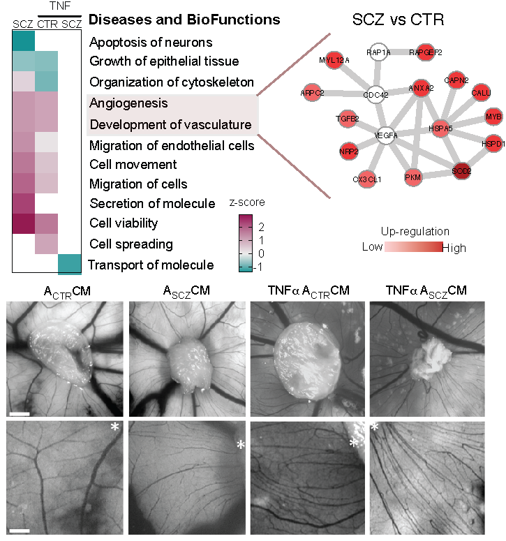 Happy to say our new #research is out in <a href="/molpsychiatry/">molecularpsychiatry</a> today! We show SCZ-derived astrocytes core inflammation may influence abnormalities in vasculature in #neurodevelopment. @StevensRehen @PabloTrindade <a href="/neuroproteomics/">Lab of Neuroproteomics</a> <a href="/Institutodor/">IDOR</a> <a href="/unicampoficial/">unicampoficial</a>