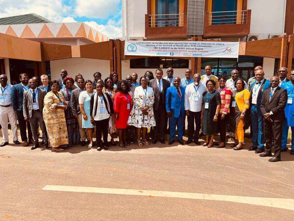 Kick-off of the meeting of the network of Buruli ulcer laboratories in <a href="/WHOAFRO/">WHO African Region</a> region, hosted by the <a href="/CentrePasteur/">Centre Pasteur du Cameroun</a> ( coordinating centre),@AmericanLeprosy <a href="/Anesvad/">Fundación Anesvad</a> <a href="/RaoulFollereau/">Fondation Raoul Follereau</a>