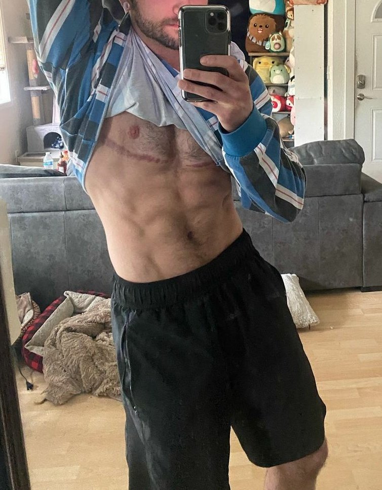 Leon Scott Kennedy🚔 

21-25 años 💋
Policia Novato de Raccoon City👮🏻‍♂️
Bisexual &amp; Chico Trans 🏳‍⚧ 
Ships Con Química 💕
Sexrol &amp; Rol con tramas libres 📖
esp / eng 🇲🇽🇺🇸

Rt.... #SexRol