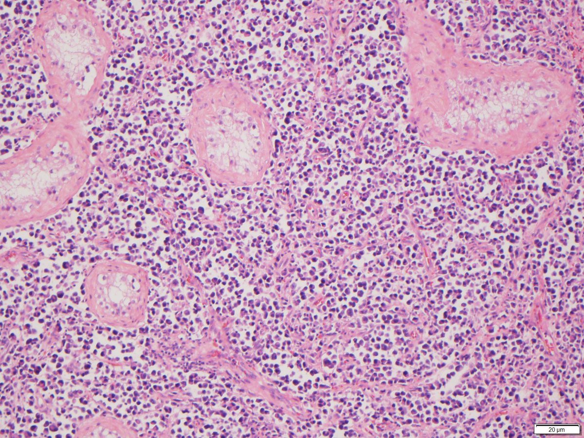 lbsmithmd's tweet photo. Organ and diagnosis? See-#hemepath doesn’t always need #ipox #Medtwitter https://t.co/grYzWQwm1Y