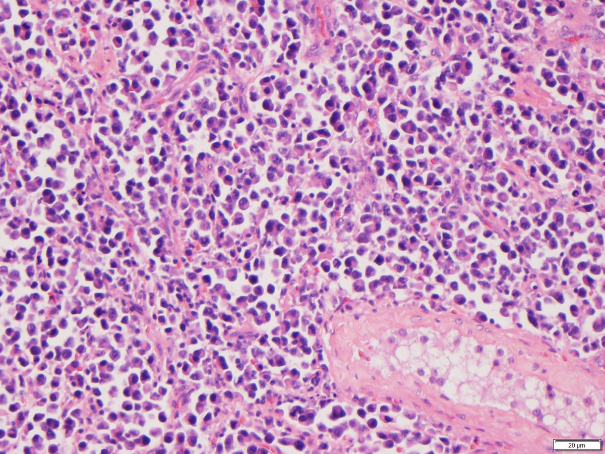 lbsmithmd's tweet photo. Organ and diagnosis? See-#hemepath doesn’t always need #ipox #Medtwitter https://t.co/grYzWQwm1Y
