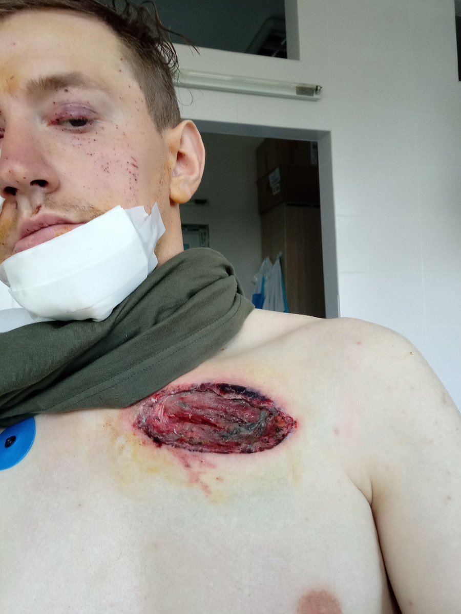 vikkahmr's tweet photo. Друзі, прошу максимальної підтримки для мого хорошого знайомого, який активно стояв на лінії оборони і пиздив русаків🤬 5375414127508322, вдячна буду кожному💔❣️ https://t.co/Mk8YXUPXXJ