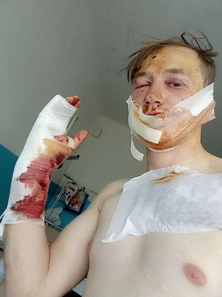 vikkahmr's tweet photo. Друзі, прошу максимальної підтримки для мого хорошого знайомого, який активно стояв на лінії оборони і пиздив русаків🤬 5375414127508322, вдячна буду кожному💔❣️ https://t.co/Mk8YXUPXXJ