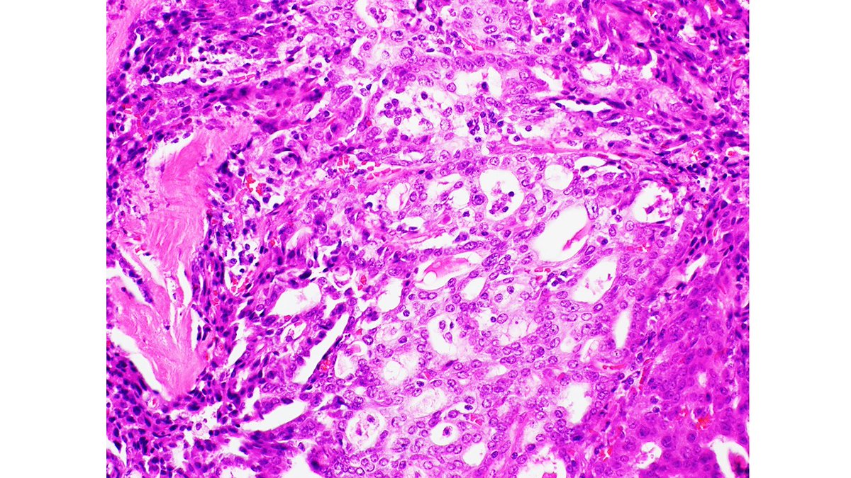 NorthShore_Path's tweet photo. #IRAP22 Case 1 presented by @KPrasai01
#NorthShore_Path https://t.co/Xf56bYObcY