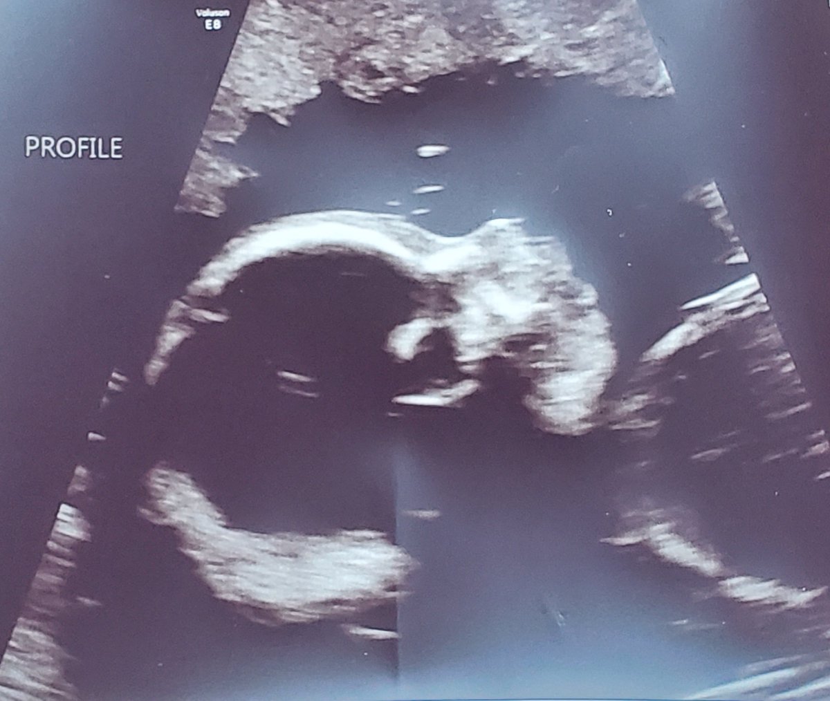 Leona Lioness tweet media