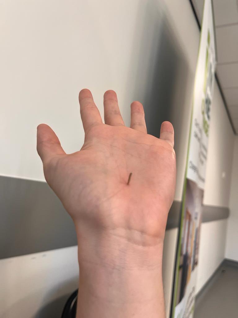 Thought something felt weird… not pictured is the many people that attempted to get this out my hand🫣