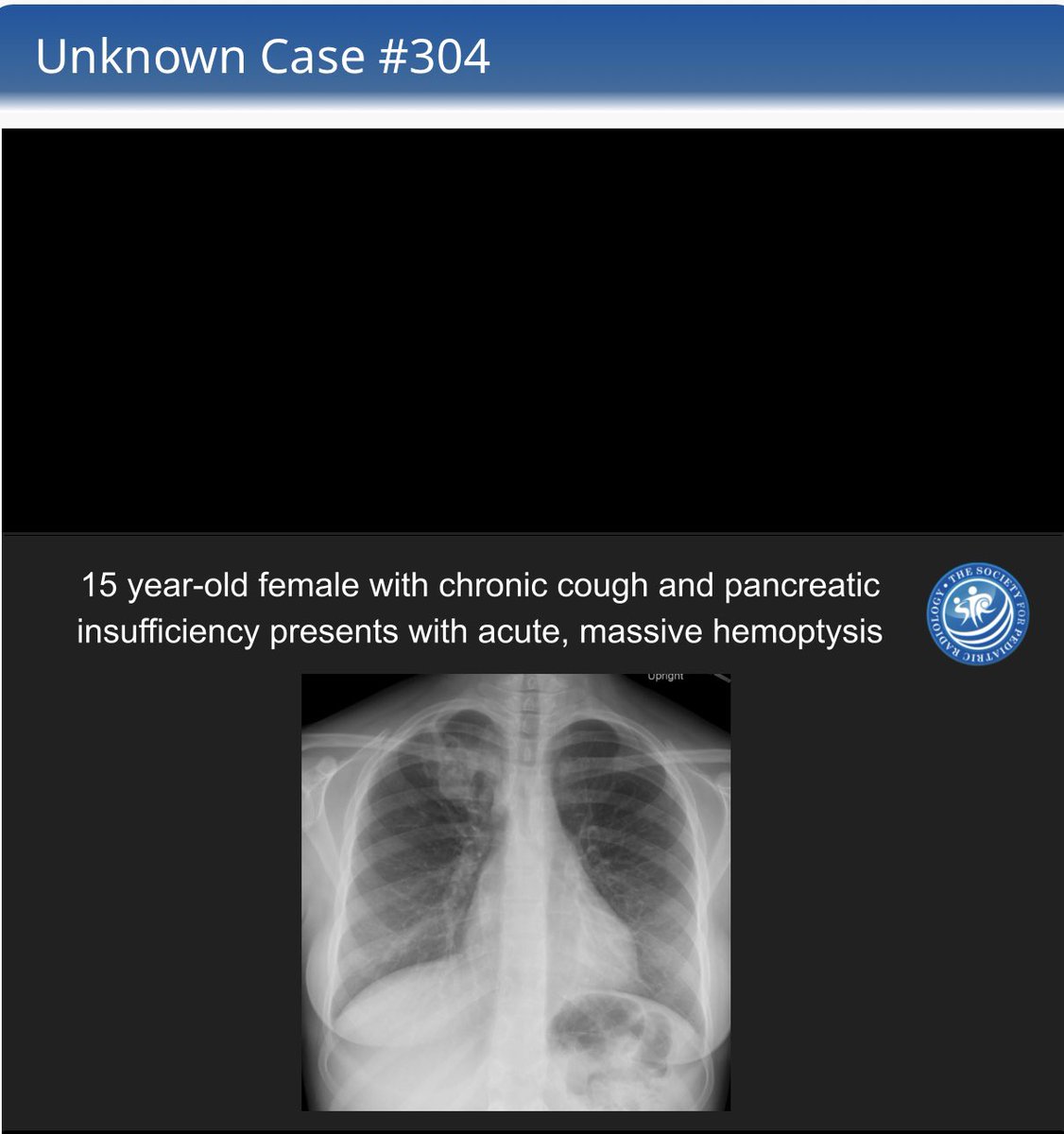 kcabsMD's tweet photo. Blending the @SocPedRad and @socpedsir worlds with help from @jade_lerner this month. https://t.co/wyRNYyClXH https://t.co/lD9ylCCspB