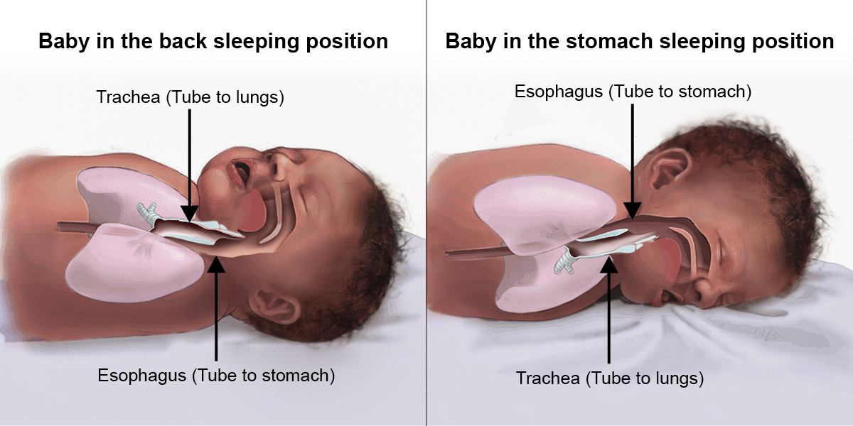RachelMoonMD's tweet photo. A4: Parents worry about babies choking on their back. Use this graphic to reassure them. @CIRPatNCH #BackisBest #CleartheCrib https://t.co/nFMUgGb35R