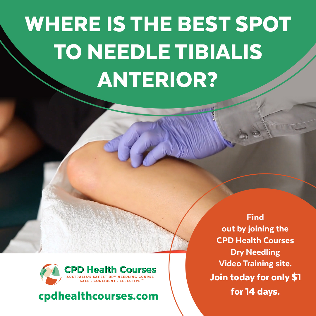 CPDHealthCourse's tweet image. I’ll show you 100% safe techniques to needle every muscle in the body. Join the Dry Needling Video Training Site (VTS) today for only $1 and get a free trial for 14 days - Take the worry out of your dry needling practice. Link in Bio. cpdhc.com/videotraining