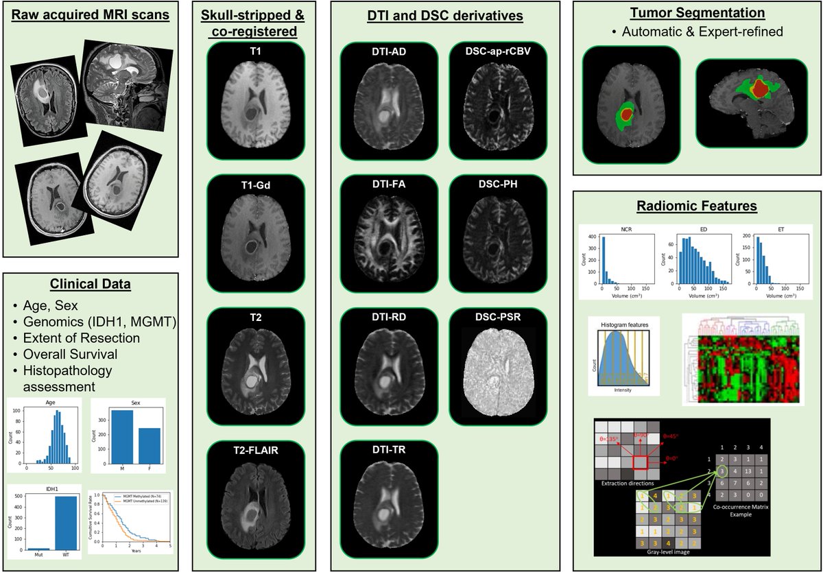 Spyridon Bakas (@spyridonbakas) on Twitter photo The UPENN-GBM data are on <a href="/TCIA_News/">CancerImagingArchive</a>!
#MRI, #histopathology #images, #clinical #outcome, #genomics, #segmentations, & #radiomics for de novo #Glioblastoma patients
Paper: nature.com/articles/s4159…
Data: doi.org/10.7937/TCIA.7…
Links to the tools in comments
<a href="/openscience/">Open Science</a> <a href="/NeuroOnc/">SNO</a> The UPENN-GBM data are on <a href="/TCIA_News/">CancerImagingArchive</a>!
#MRI, #histopathology #images, #clinical #outcome, #genomics, #segmentations, & #radiomics for de novo #Glioblastoma patients
Paper: nature.com/articles/s4159…
Data: doi.org/10.7937/TCIA.7…
Links to the tools in comments
<a href="/openscience/">Open Science</a> <a href="/NeuroOnc/">SNO</a>