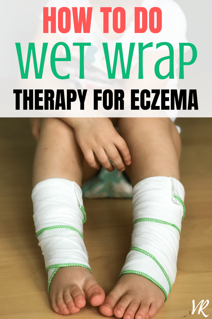 DOKTOR, APA ITU WET-WRAP THERAPY?

Hello orang ramai! 

Wetwrap therapy (WWT) terbukti berkesan dalam mengurangkan gelaja gatal dan keterukan penyakit eczema. Ramai pesakit saya sukakan WWT. Jom belajar cara betul utk melakukan WWT. 

Threads!