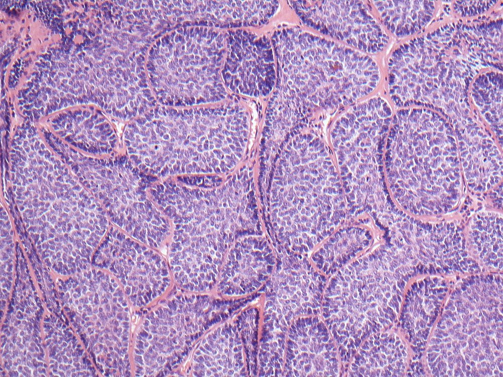 Oral Path Opinion tweet media