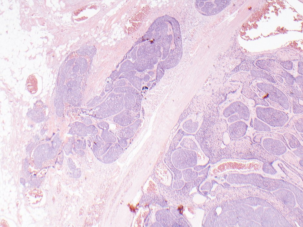 Oral Path Opinion tweet media