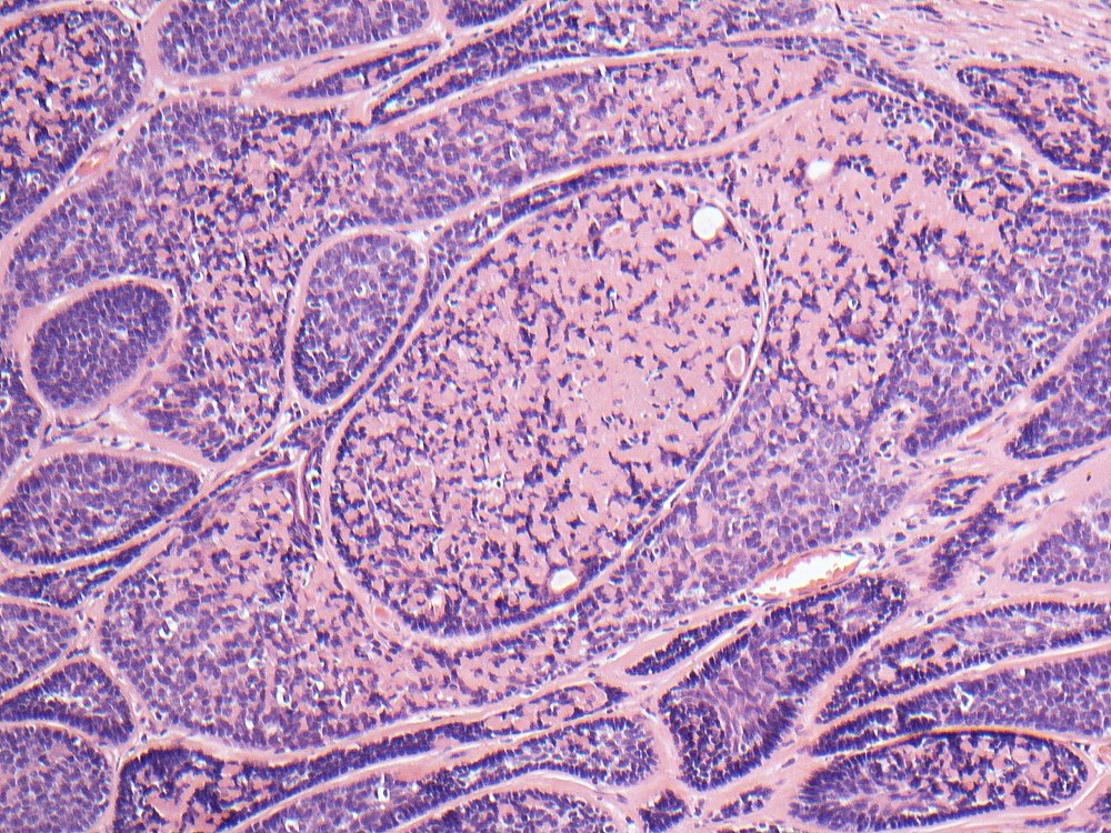 Oral Path Opinion tweet media