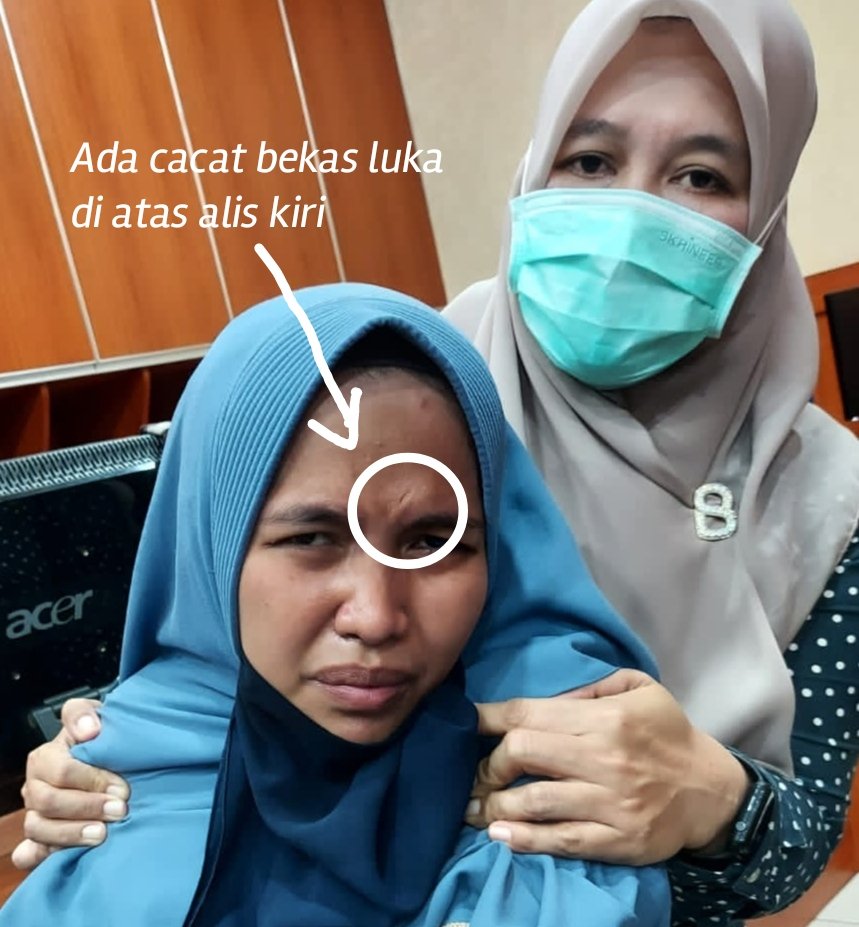 abuazha86010153's tweet photo. @HukumDan @Miduk17 Pelaku waktu ditangkap... 

Perhatikan warna jilbab dan cadarnya.
Tak ada bekas luka diatas alis.
Bentuk tangan dan cara mengepal tangan itu adalah laki-laki.. https://t.co/h04wloqDc2