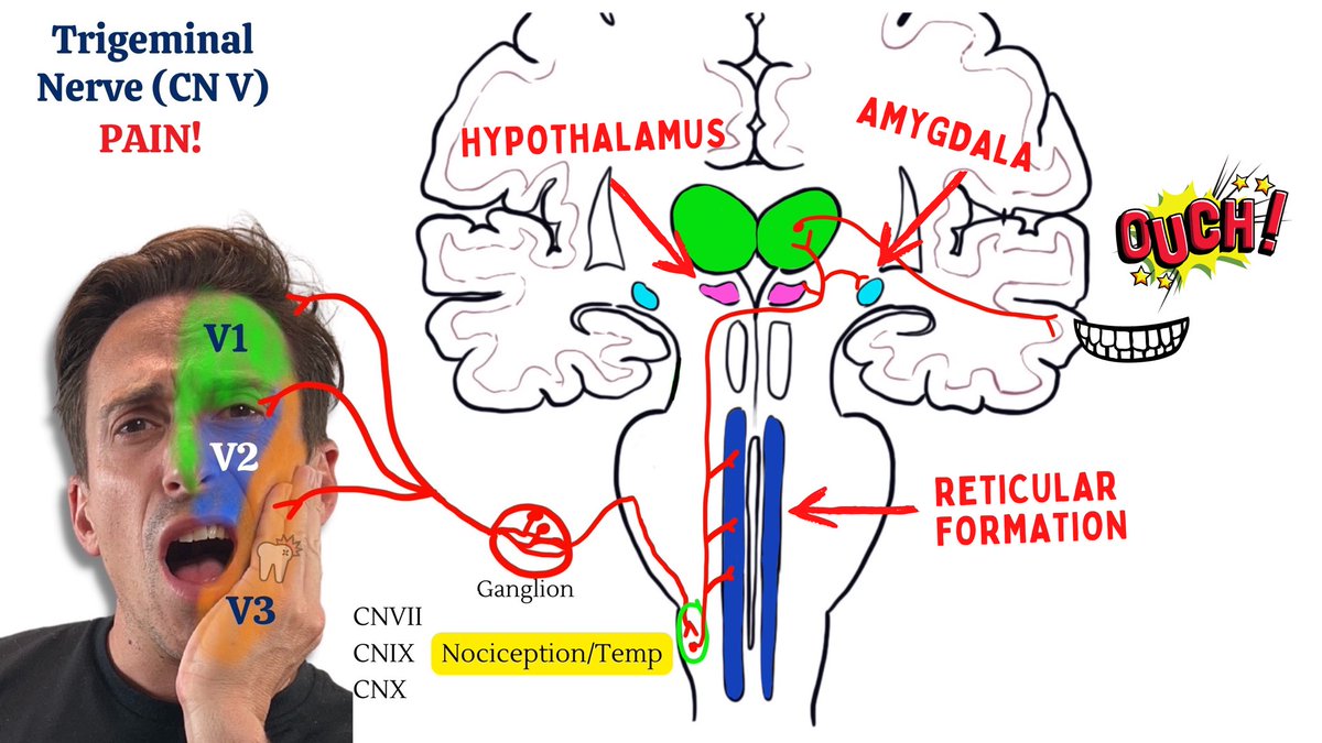 drmiketodorovic's tweet image. “Acute Pulpitis is a Real Pain!” 🦷 💥 
I’ve been invited to speak at @AusDental conference this Friday and Saturday. 
Here’s one of the slides highlighting some important aspects of the pain matrix!!
#pain #trigeminal #tooth #MedEd #MedTwitter