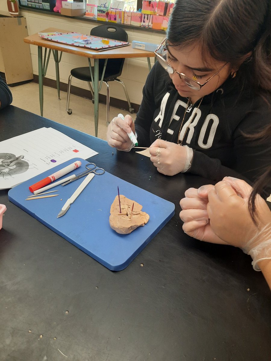 mrs_wheeley's tweet photo. Kidney Dissection Day! The first dissection lab of the semester is always a fun moment for my students. They either love me or hate me after today. #HealthScience #CTEforNC #DissectionLab #Anatomy #HandsOnLearning @TCSCTE @CTEforNC @thomasvillehigh https://t.co/xtA4RR6p3V