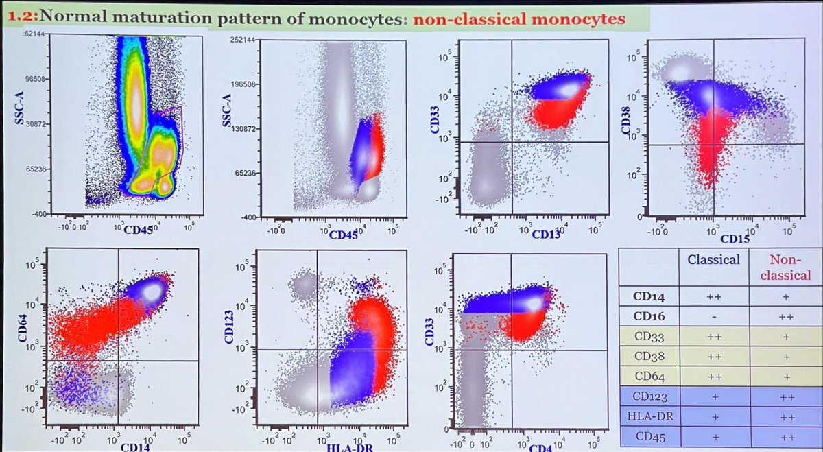sanamloghavi's tweet photo. Now on to #monocytes… here is the normal immunophenotypic maturation patterns and a summary of common monocytic aberrancies in myeloid neoplasms  #flowiccs #hemepath by Dr. Wei Wang of #hemepathMDA #leusm https://t.co/BPrc6TCWeN