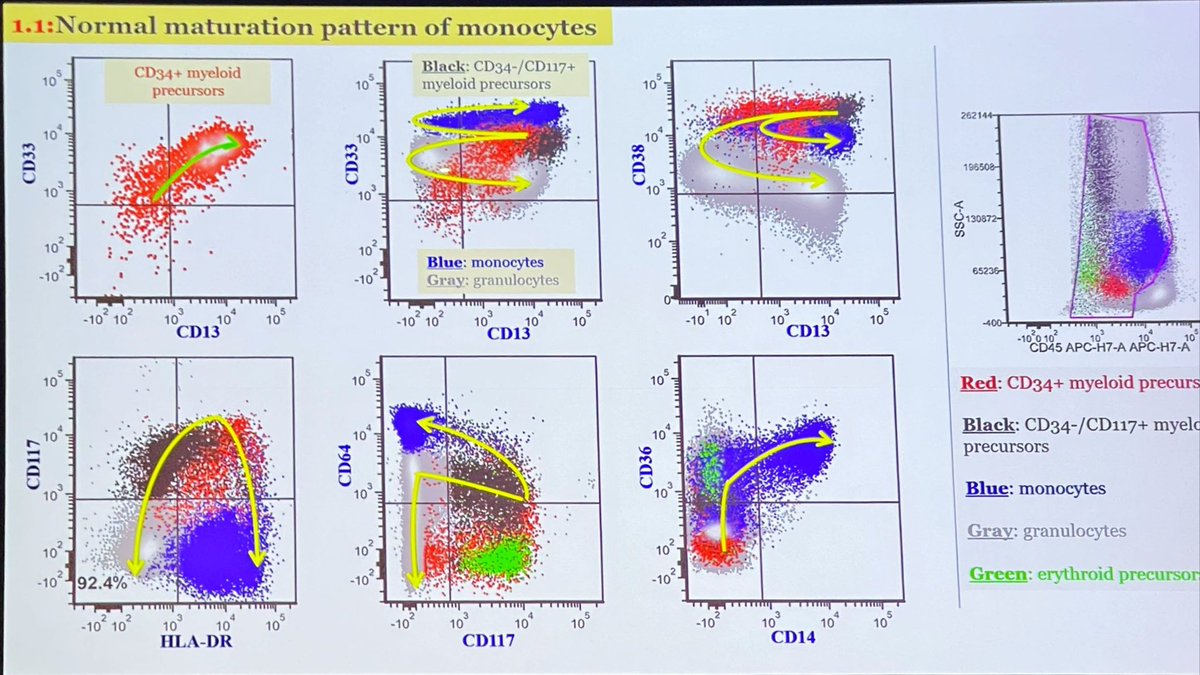 sanamloghavi's tweet photo. Now on to #monocytes… here is the normal immunophenotypic maturation patterns and a summary of common monocytic aberrancies in myeloid neoplasms  #flowiccs #hemepath by Dr. Wei Wang of #hemepathMDA #leusm https://t.co/BPrc6TCWeN