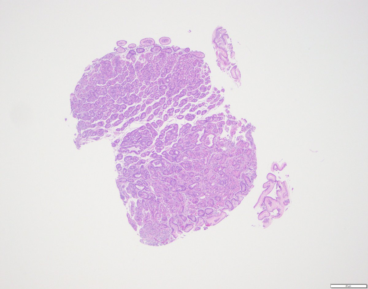 stephen_lagana's tweet photo. #GIpathology ain't easy!! https://t.co/OH0YYlmbPK