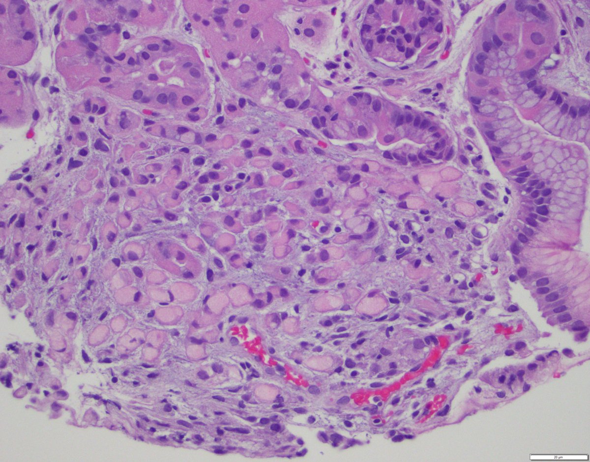 stephen_lagana's tweet photo. #GIpathology ain't easy!! https://t.co/OH0YYlmbPK