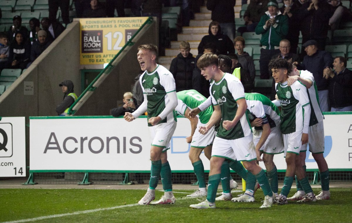 HibernianFC's tweet image. 24 hours to go! ⏳

🎟 tinyurl.com/5bt8kr7y

#UYL