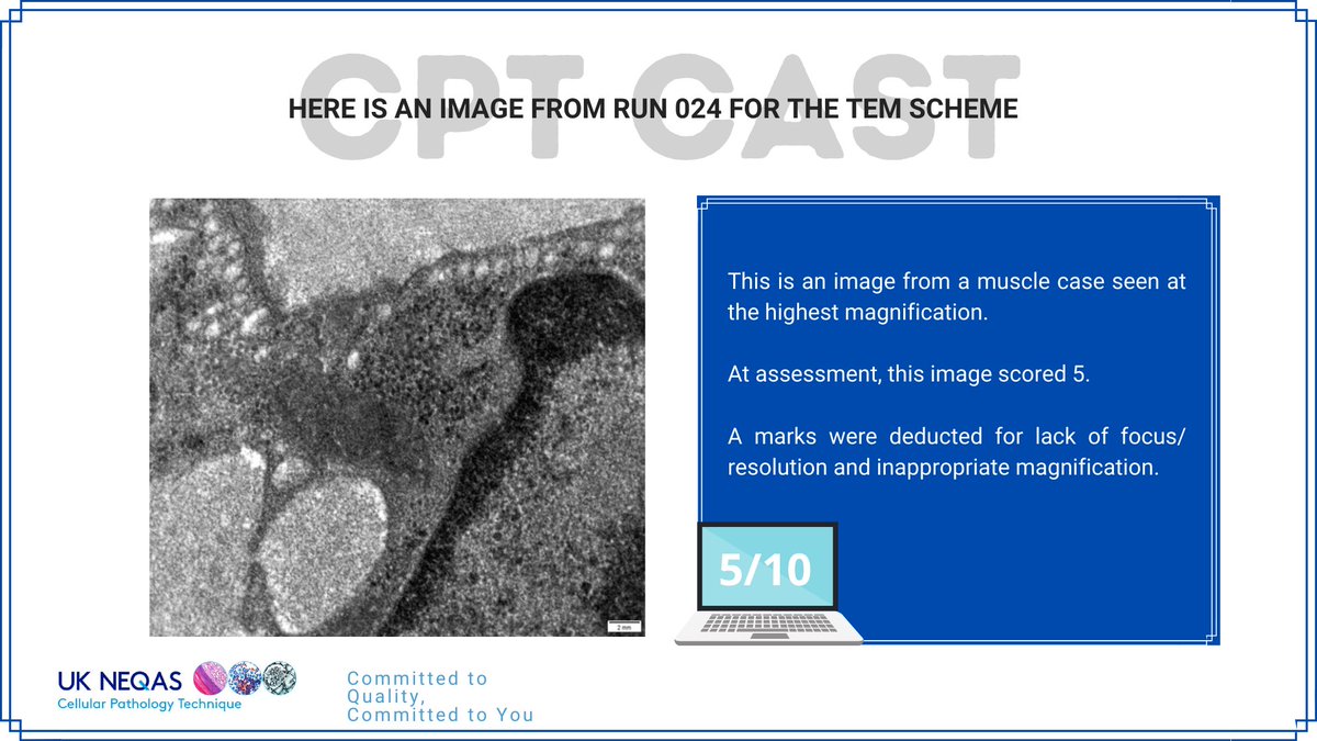 ukneqascpt's tweet image. This image from the TEM scheme scored a 5/10 at assessment. 

Do you agree? 🤔
#cptcast #transmissionelectonmicroscopy
#ukneqasTEMscheme
#cellularpathology
#ukneqascptassessment