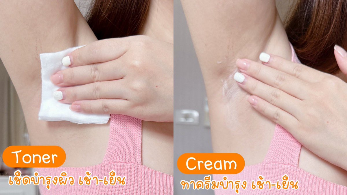faifaii_12's tweet photo. เคล็ดลับ #เซ็ตฟื้นฟูรักแร้คูณสอง รักแร้ไม่คล้ำ ลดหนังไก่ของเรา🥞Butter Sweet Toning Toner&amp; Cream คู่นี้เลย ลดกลิ่นตัว รักแร้ดูขาวขึ้นเรื่อยๆ พวกหนังไก่คือลดลงแบบเห็นได้ แถมกลิ่นหอมมาก น่ากินสุดดด #buttersweet #ใช้ดีบอกต่อ https://t.co/b9D5J7MDK4