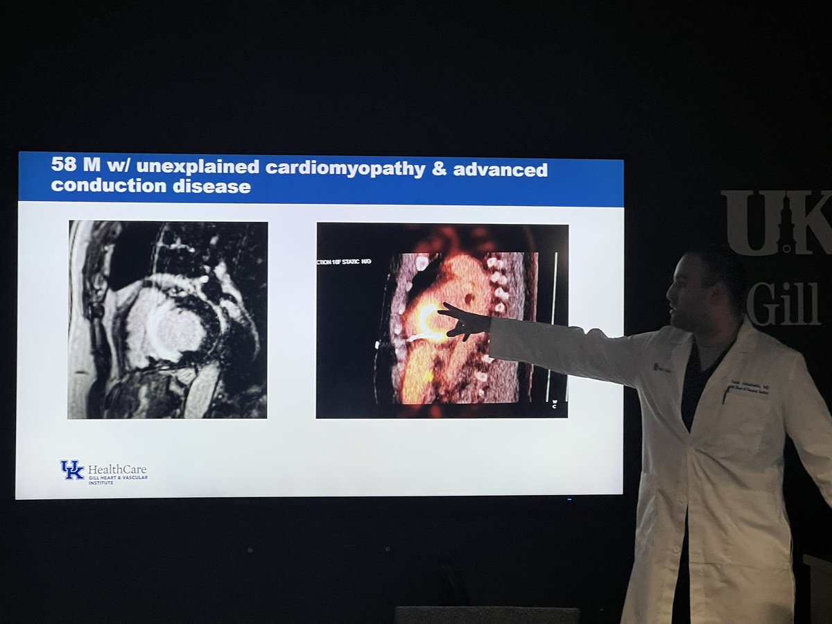 VLSorrellImages's tweet photo. #JADIL
Great update this AM for @Kentucky_Cards fellows on Metabolic Imaging in the heart!
Remember: fasting / prep is critical!
@swleun2
@MyASNC
#PET
#sarcoidosis #MasqueradeMonday https://t.co/eYnrdxx9G5