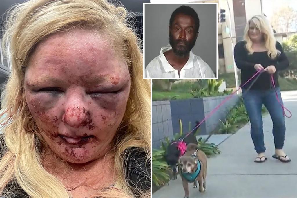 nypost's tweet photo. California woman recalls horrifying attack by homeless man https://t.co/XOkgebNSU8 https://t.co/VmPBgCIeZH
