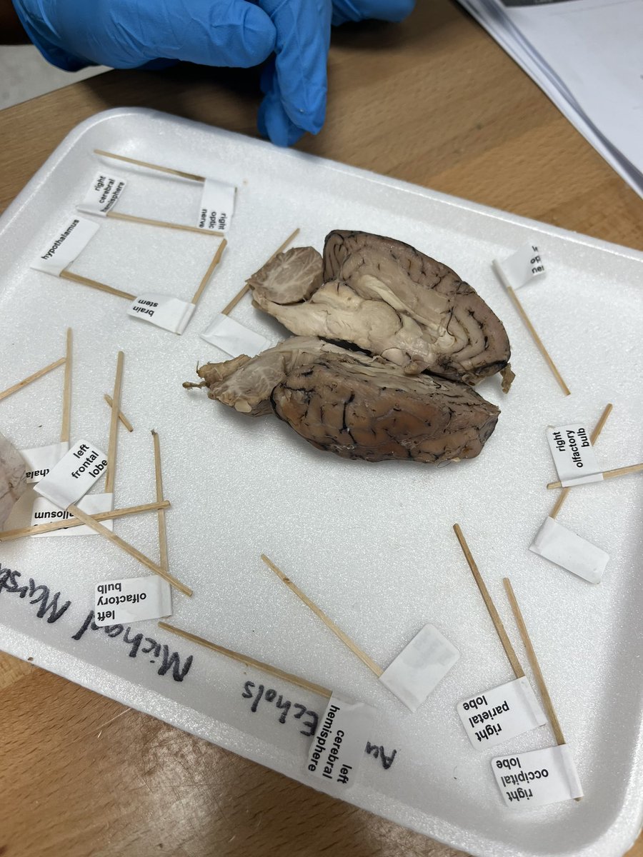 JMCSSNortheast's tweet photo. 🐆🧠 Brain dissections took place today! Future neuro surgeons at NMS during 7th grade PLTW Medical Detectives class 🧠🐆 #futuredrs #NMSjags #WeAreOne https://t.co/WfUyt5toa6