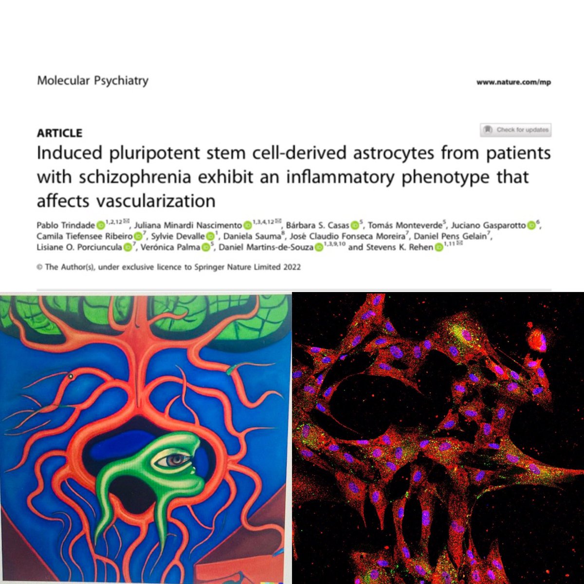 In this new <a href="/molpsychiatry/">molecularpsychiatry</a> led by <a href="/stevensrehen/">Stevens Rehen</a> we describe how astrocytes from schizophrenic patients affect vascularizarion. Thanks for the opportunity to collaborate <a href="/pablotrindade/">Pablo Trindade</a> <a href="/juminasc/">Juliana Minardi (em 🏡)</a> <a href="/neuroproteomics/">Lab of Neuroproteomics</a> 
Art created by @DALL-E inspired in Tarsila do Amaral painting.
