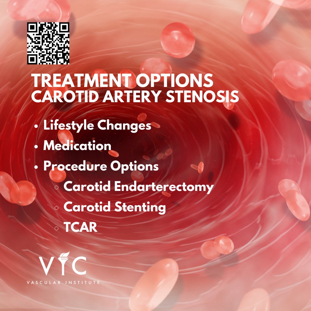 What can be done if you have been diagnosed with CAS?
#VICOctober #VIC #VICVascular #Veins #Endovascular #ArteryDisease #FLOW #VascularSurgery #VaricoseVeins #PAD #CAS #RAS #Aneurysm #Arterial #CLI #CLIFighter #Carotid #Peripheral #Renal #Atherosclerosis #Plaque #Stroke