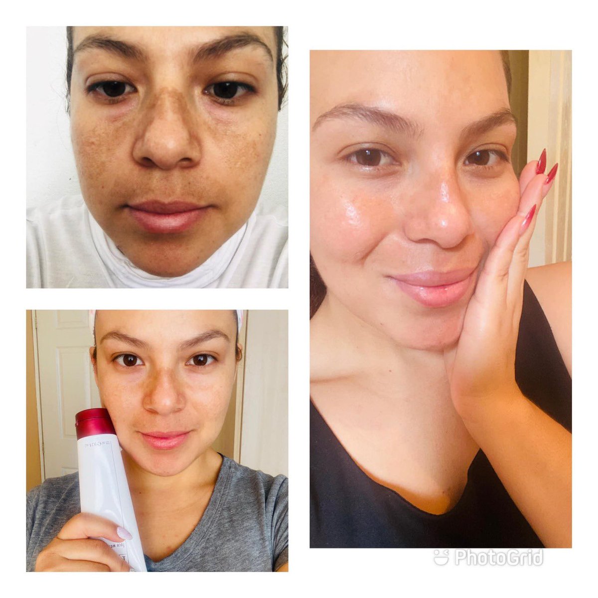 karletms's tweet photo. #facewash180 #skin #beautiful info conmigo!!!📲Ánimate  a lograr el cambio en tu piel, cómo siempre lo has querido! https://t.co/tC31HpBqK0
