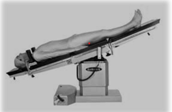 Why are people still using Trendelenburg position for hypotensive ED pts (Trauma, GIB, sepsis etc)??  Zero cardiovascular benefits but  increases risk of vomiting/aspiration &amp; decreases tidal volume

Stop it

pubmed.ncbi.nlm.nih.gov/16120887/