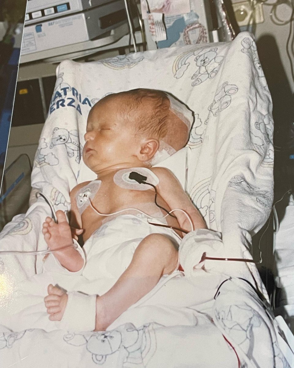 coco_coindreau's tweet photo. I live my life under constant pressure and rise up to every challenge #WSBHD #worldspinabifidaandhydrocephalusday #hydrowarrior #keepcalmandshunton https://t.co/OPsGxwKSHa