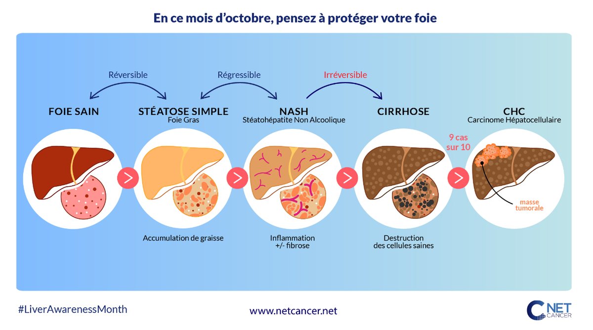 [#LiverAwarnessMonth]
À l'occasion du #livermonth, NetCancer vous encourage dans la prévention des maladies du foie.

⚠️ 9 carcinome hépatocellulaire sur 10 sont issus d'un foie cirrhotique. 
À la moindre question sur l’état de santé de votre foie, n'hésitez pas à consulter.