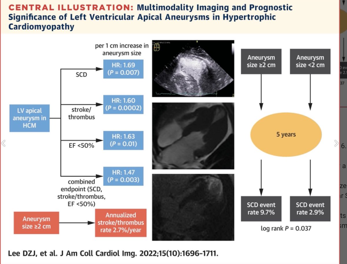 MAecocardio's tweet photo. Interesantísimo trabajo 
Aneurisma apical en la miocardiopatia hipertrofica:
Mal pronóstico si >2cm : considerar anticoagulacion profiláctica y prevención primaria con desfibrilador .
https://t.co/g7KZPbj0U4 https://t.co/3Uw4JgWn7w