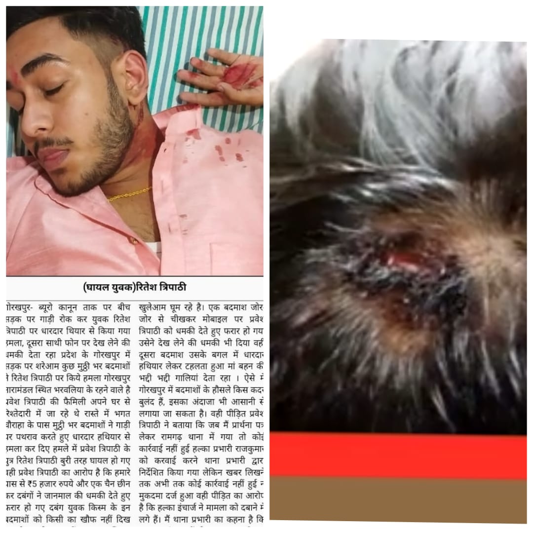 RohitTi44222439's tweet photo. https://t.co/yXYU52oYag 
@myogiadityanath , @Uppolice  @aajtak https://t.co/hLZhg7Yb0V