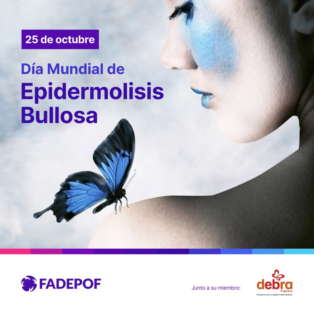 La Epidermolisis Bullosa es una EPOF también llamada como “ Piel de Mariposa” y se caracteriza por una extrema fragilidad de la piel provocada por una mutación genética que impide la producción correcta de ciertas proteínas que funcionan de ‘pegamento’ entre las diferentes capas.