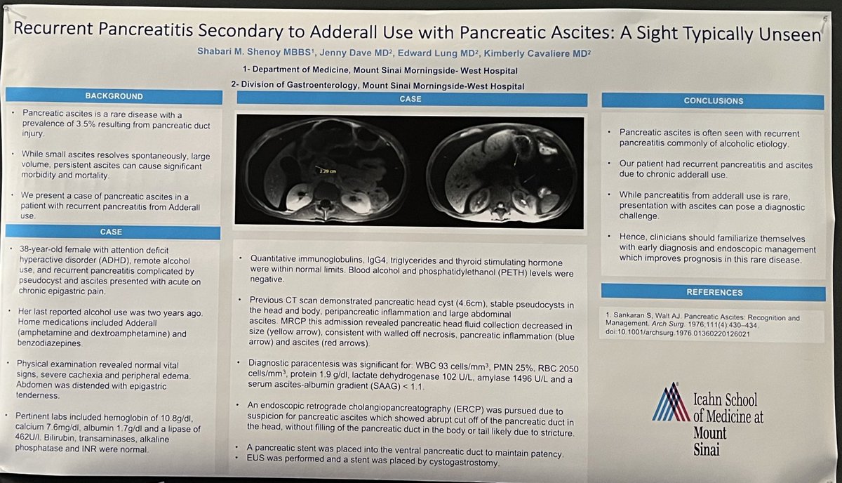 shabarishenoy's tweet photo. Check out our case of recurrent pancreatitis secondary to adderall use complicated by pancreatic ascites @AmCollegeGastro 

Thank you Drs @KCavaliereMD and Lung https://t.co/aAyLoTvhfO