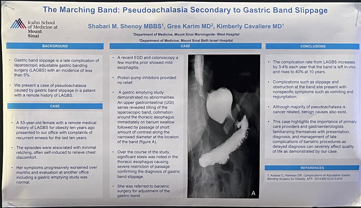 shabarishenoy's tweet photo. Our case on pseudoachalasia secondary  to gastric band slippage following laparoscopic adjustable gastric banding surgery @AmCollegeGastro @KCavaliereMD 

Important to recognise early and late complications of bariatric surgery https://t.co/pSg8U96Qio