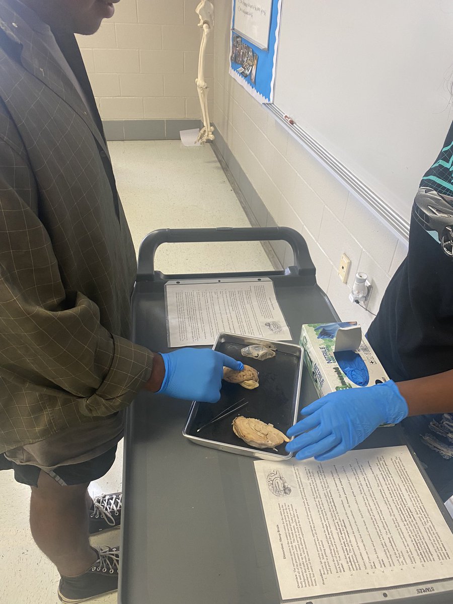 itsmayrogers's tweet photo. Students got to glove up this week and look at a real brain. Dissection days are some of my favorite because it takes concepts into real life! Many students are in shock when they realize terms from a diagram can actually be seen with the naked eye! #SHSscience #STEMeducation https://t.co/Z7XpCgnbql