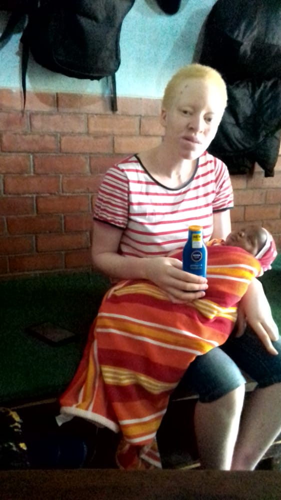 You see the right side those small wounds if not treated early they will grow and become difficult to manage, we are appealing to you people so we assist our dear sister call app 0714812130