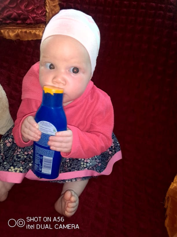 Lets support these young ones to build a better tomorrow they need protective clothing, The reddish on her chicks are sun burns and those they will cause cancer in future, call app 0714812130